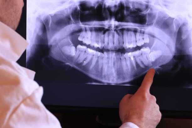 Best Broken Tooth Emergency  in Sunnyside, GA